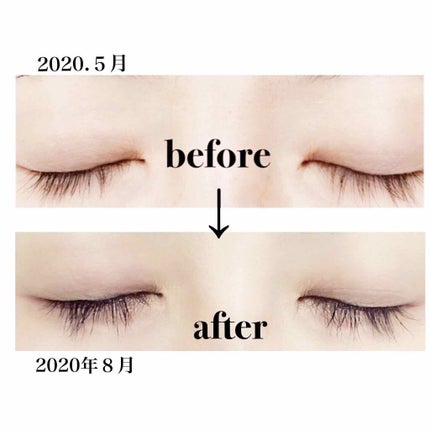 EMAKED(エマーキット)/水橋保寿堂製薬/まつげ美容液を使ったクチコミ(2枚目)