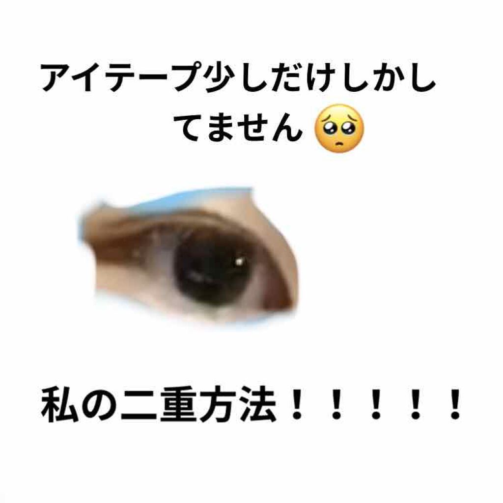 二重まぶた用シール/DAISO/二重まぶた用アイテムを使ったクチコミ（1枚目）