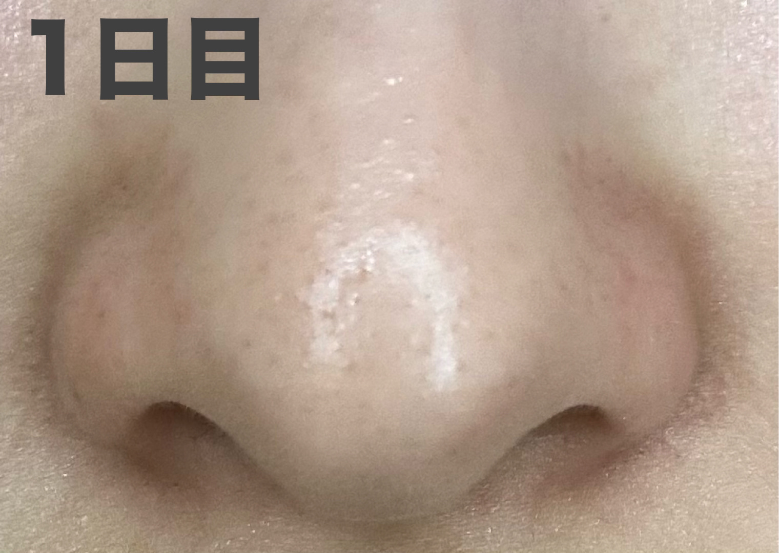 3番 緑茶炭毛穴パッククレンジングバーム/numbuzin/クレンジングバームを使ったクチコミ（3枚目）