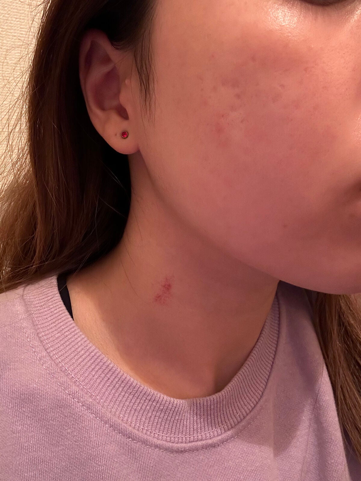 レチノールA 1% アドバンスドリバイタリゼーションクリーム/Life-flo/フェイスクリームを使ったクチコミ(2枚目)