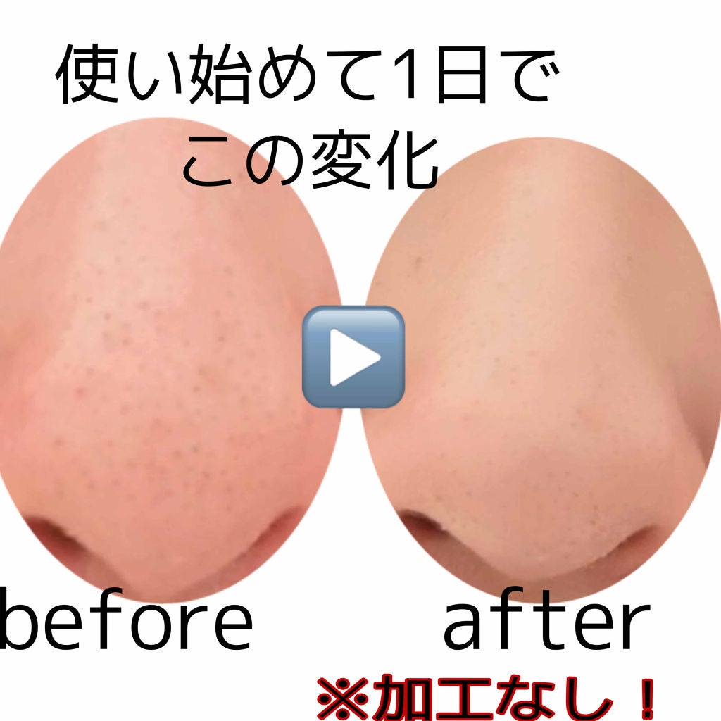 スーパーヴォルカニック ポアクレイマスク/innisfree/洗い流すパック・マスクを使ったクチコミ(2枚目)