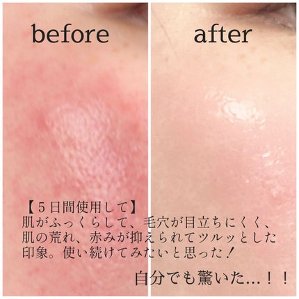 レチノールインテンシブ アドバンスドトリプルアクションアイクリーム/SOME BY MI/アイケア・アイクリームを使ったクチコミ(6枚目)