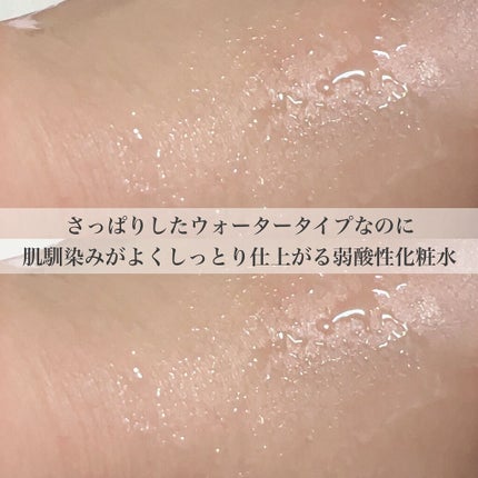 AZアゼライン酸10セラム/コスデバハ/美容液を使ったクチコミ(3枚目)