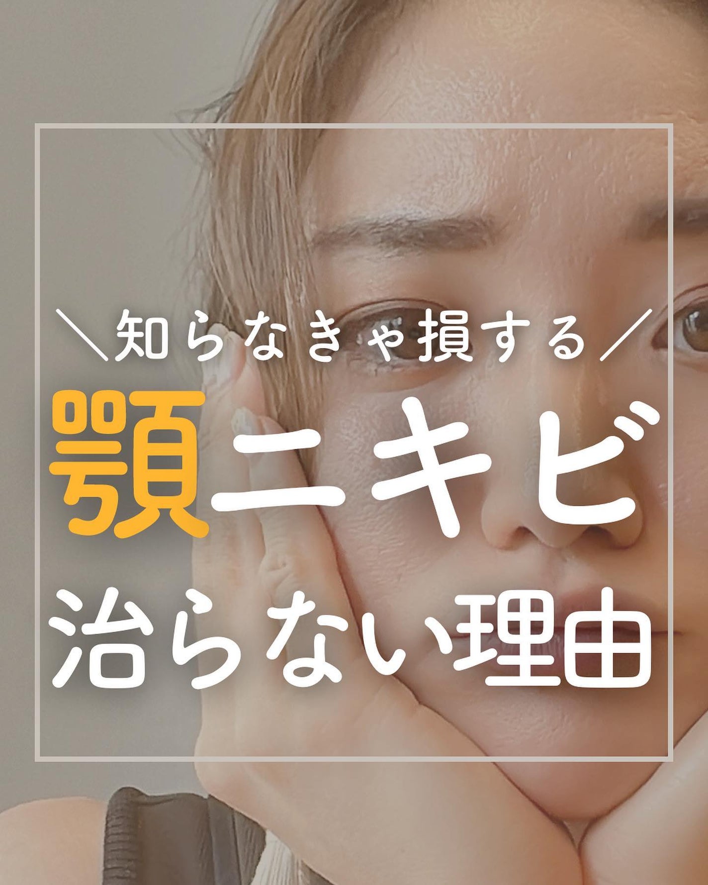 おゆみ|ニキビ・ニキビ跡ケア on LIPS 「@______ohyoume 他の投稿はこちらから👋【顎ニキビ..」(1枚目)