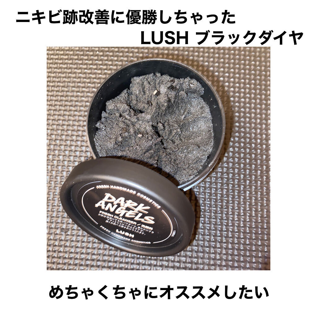 ブレーキ まだ 彫る Lush 洗顔 ニキビ 跡 Campuscafe Jp
