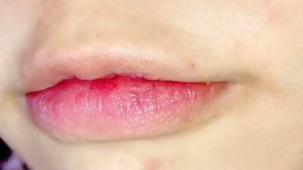 マシュマロティントルージュ/フォーチュン/リップティントを使ったクチコミ(6枚目)