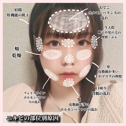 天使の美肌水/天使の美肌工房(天使の美肌化粧品)/ボディローションを使ったクチコミ(1枚目)