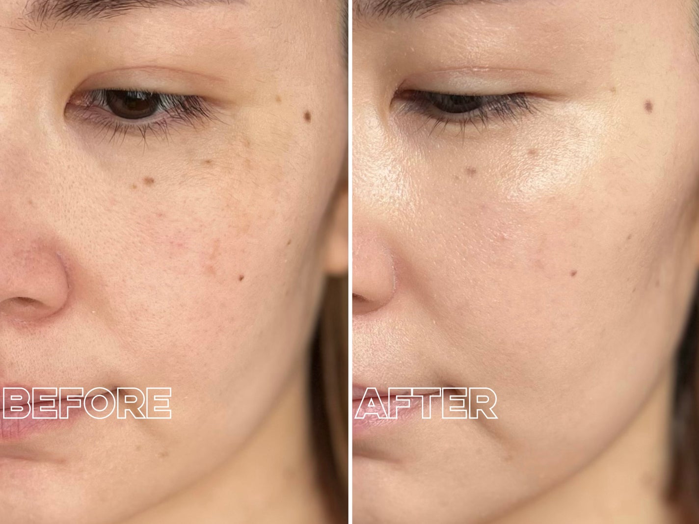 コンシールブレンダーパレット/LUNA/パレットコンシーラーを使ったクチコミ(4枚目)