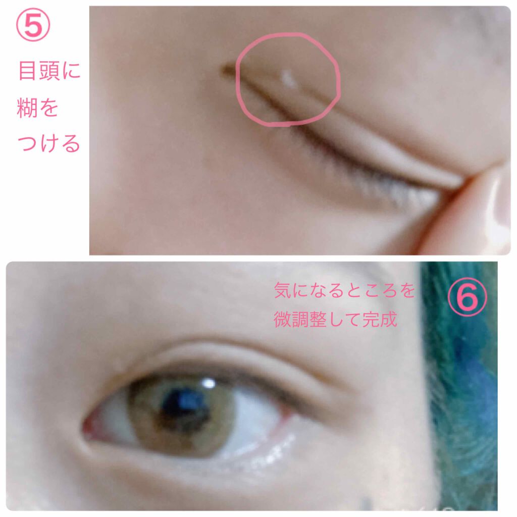 アイトーク/アイトーク/二重まぶた用アイテムを使ったクチコミ（3枚目）