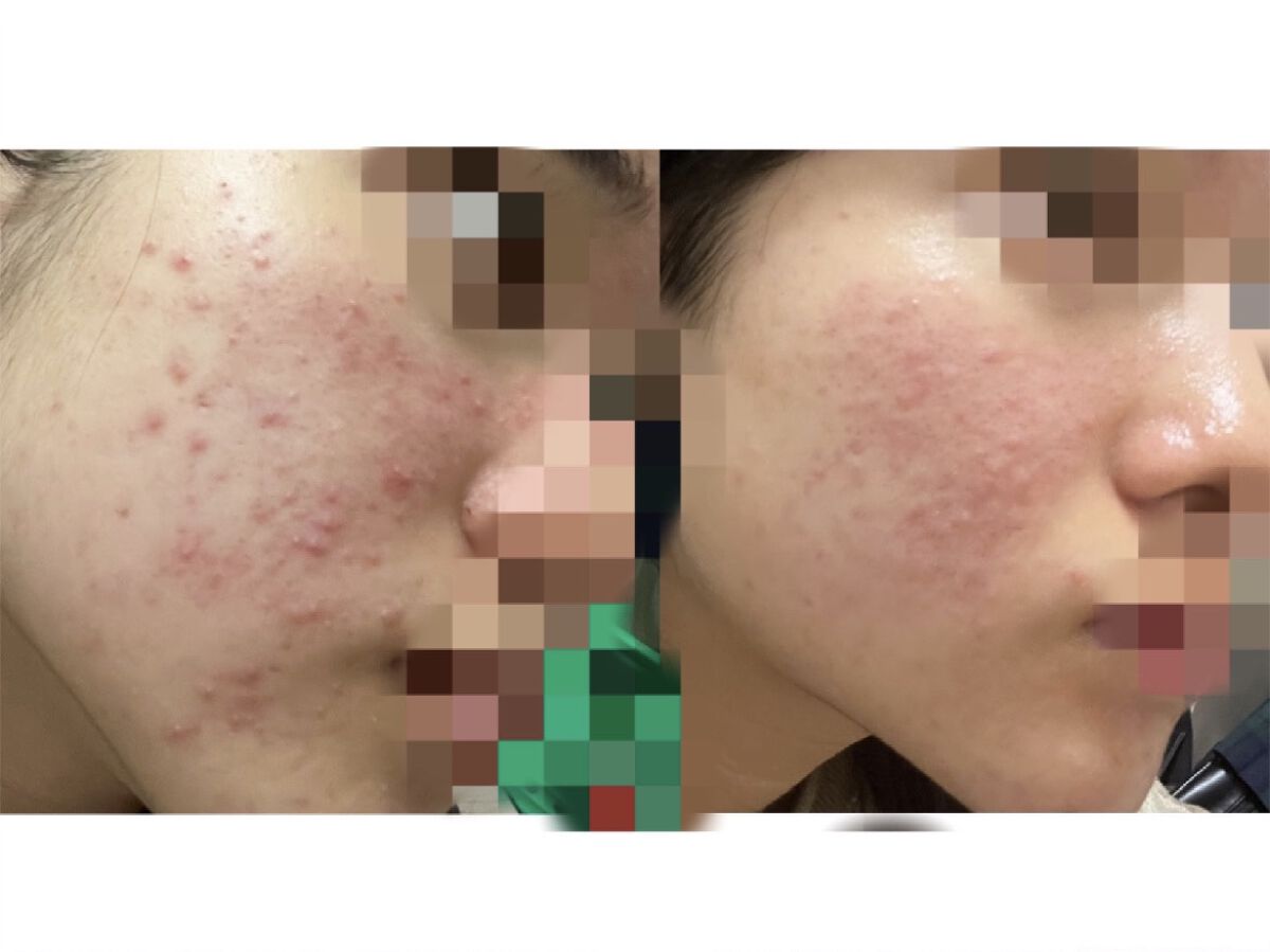 薬用 雪肌精/雪肌精/化粧水を使ったクチコミ（1枚目）