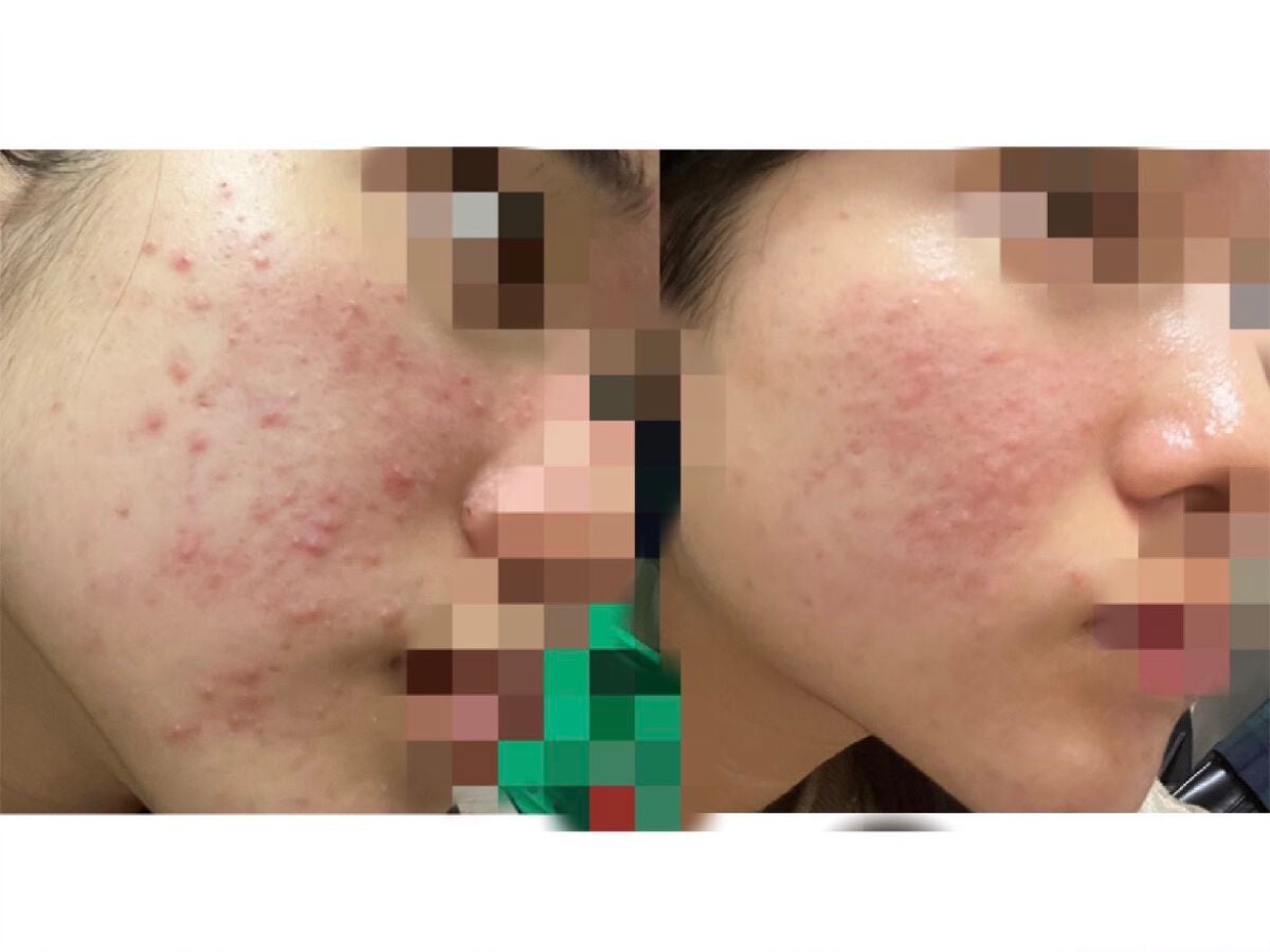 白潤 薬用美白乳液/肌ラボ/乳液を使ったクチコミ(1枚目)