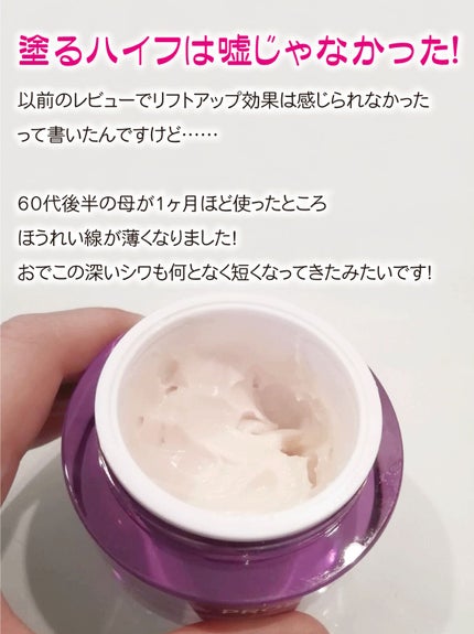 プロバイオダーム リフティング クリーム/BIOHEAL BOH/フェイスクリームを使ったクチコミ(2枚目)
