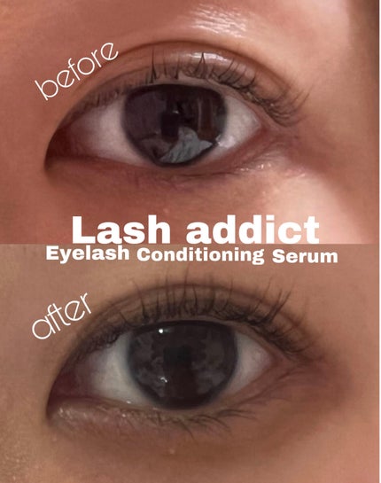 ラッシュアディクト アイラッシュコンディショニングセラム/soaddicted/まつげ美容液を使ったクチコミ(1枚目)