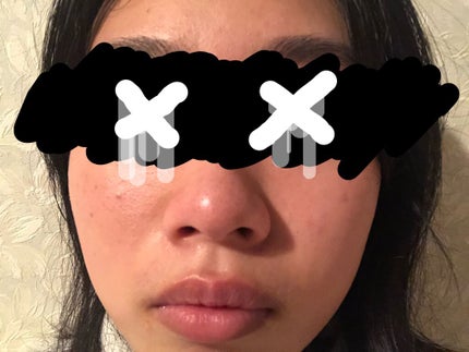 艶肌ドロップ/ラッシュ/美容液を使ったクチコミ(6枚目)