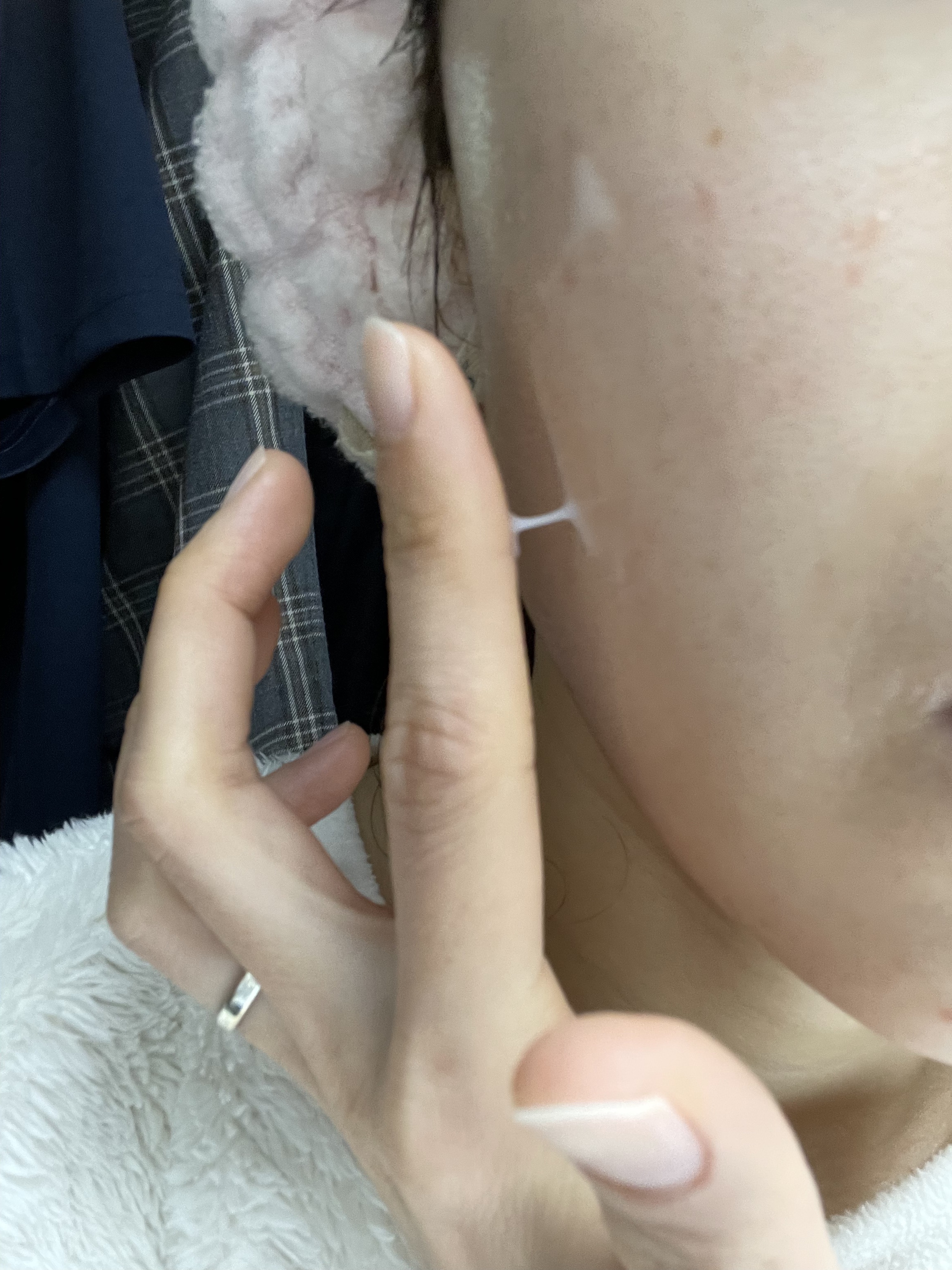 プロバイオシカ インテンシブ アンプル/SKIN1004/美容液を使ったクチコミ（3枚目）