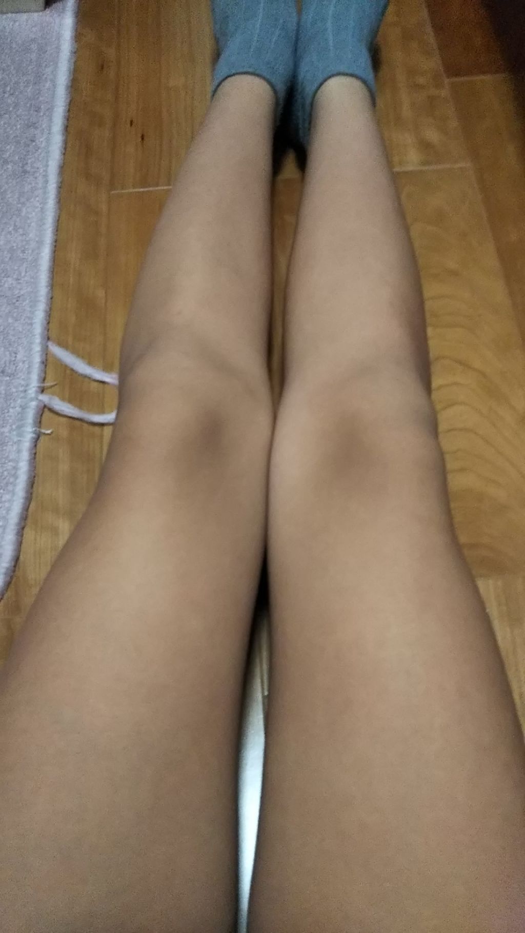 薬用美白 オールインワンジェル/DAISO/オールインワン化粧品を使ったクチコミ（2枚目）