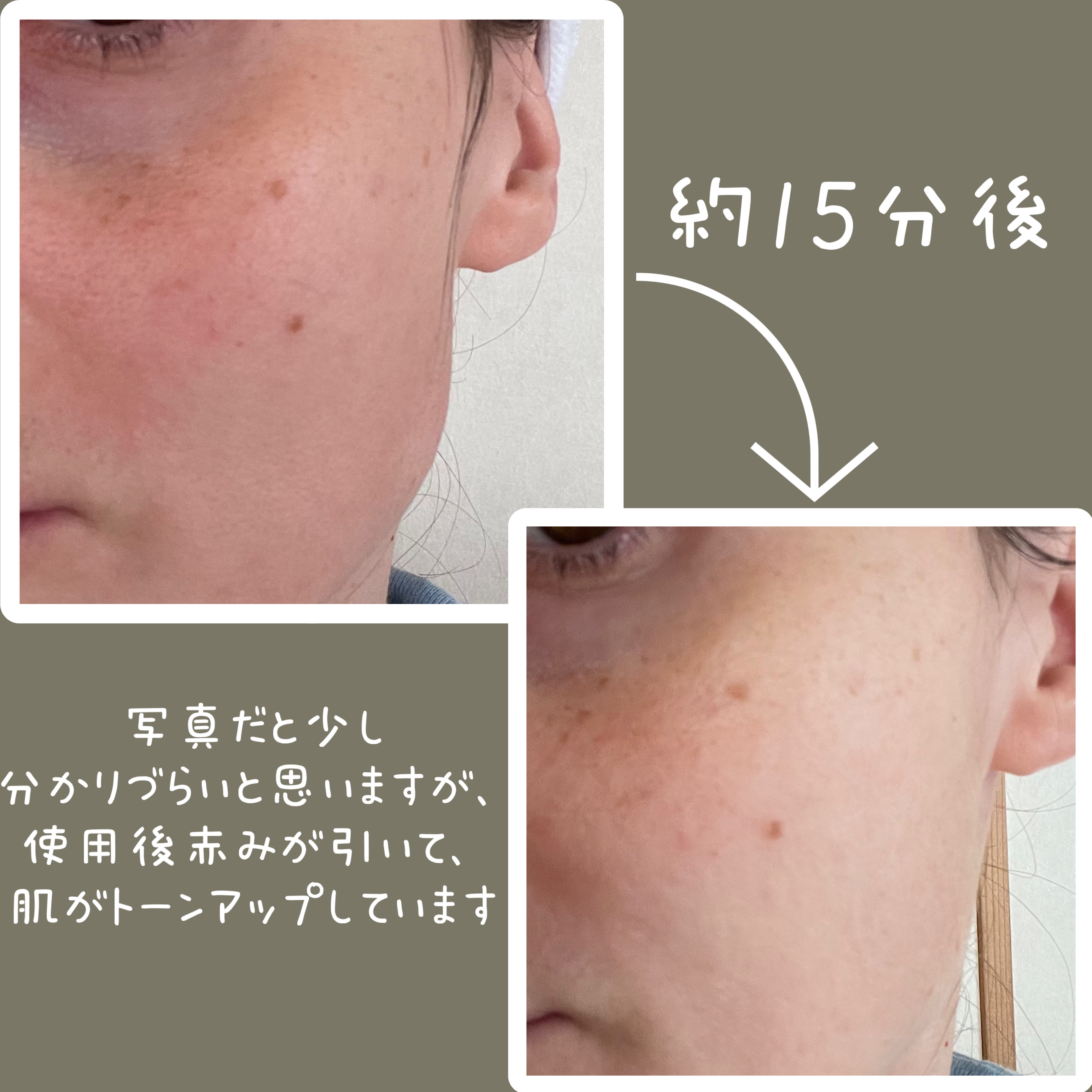 ナイアシンアミドビタミンC ブライトニングマスク/MARY&MAY/シートマスク・パックを使ったクチコミ（3枚目）