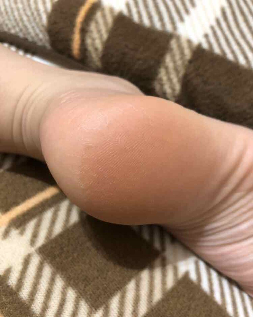 ニベアクリーム/ニベア/ボディクリームを使ったクチコミ(3枚目)