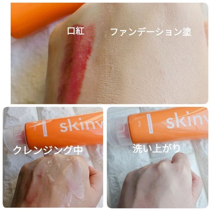 ホットクレンジングジェル/skinvill/クレンジングジェルを使ったクチコミ(4枚目)