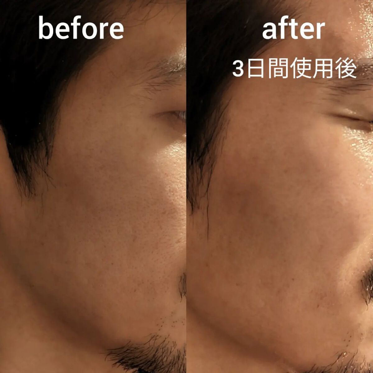 ハリシュ/北の快適工房/ミスト状化粧水を使ったクチコミ（3枚目）