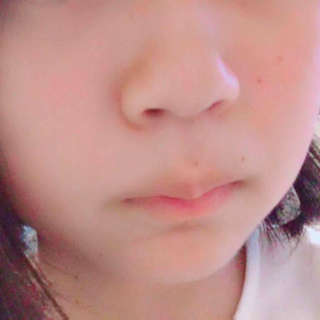 薬用美白 美容液/DAISO/美容液を使ったクチコミ（2枚目）