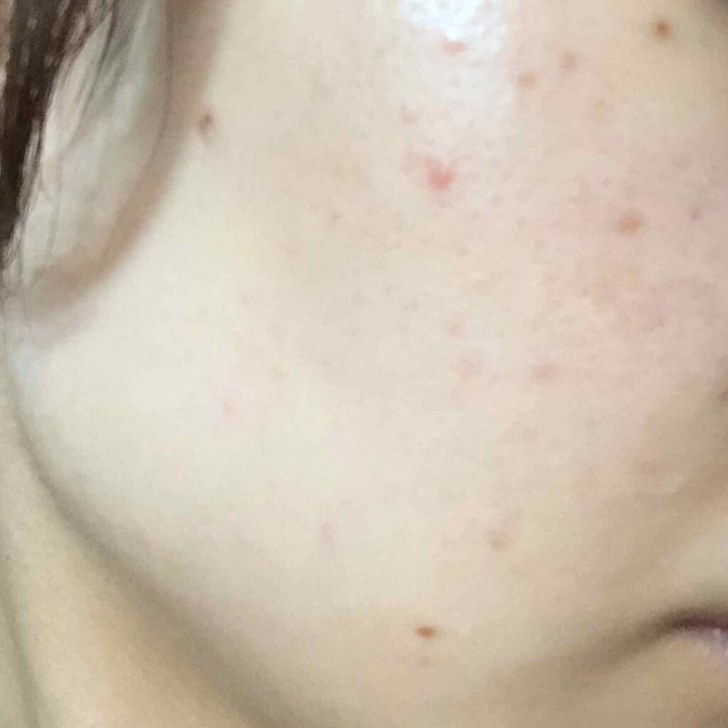 潤浸保湿 フェイスクリーム/キュレル/フェイスクリームを使ったクチコミ(3枚目)