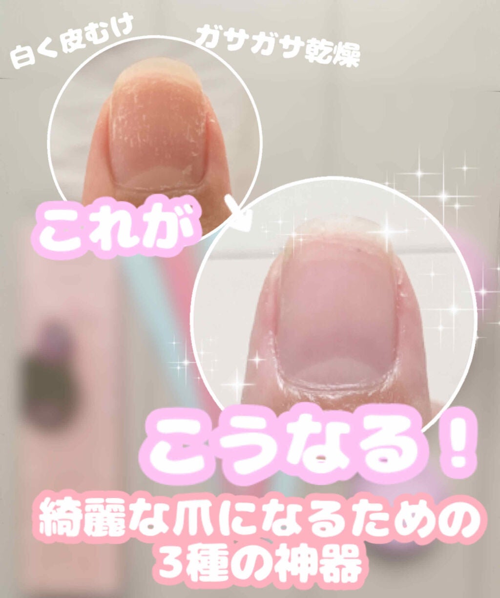 ネイルスムース/デュカート/ネイル用品を使ったクチコミ(1枚目)