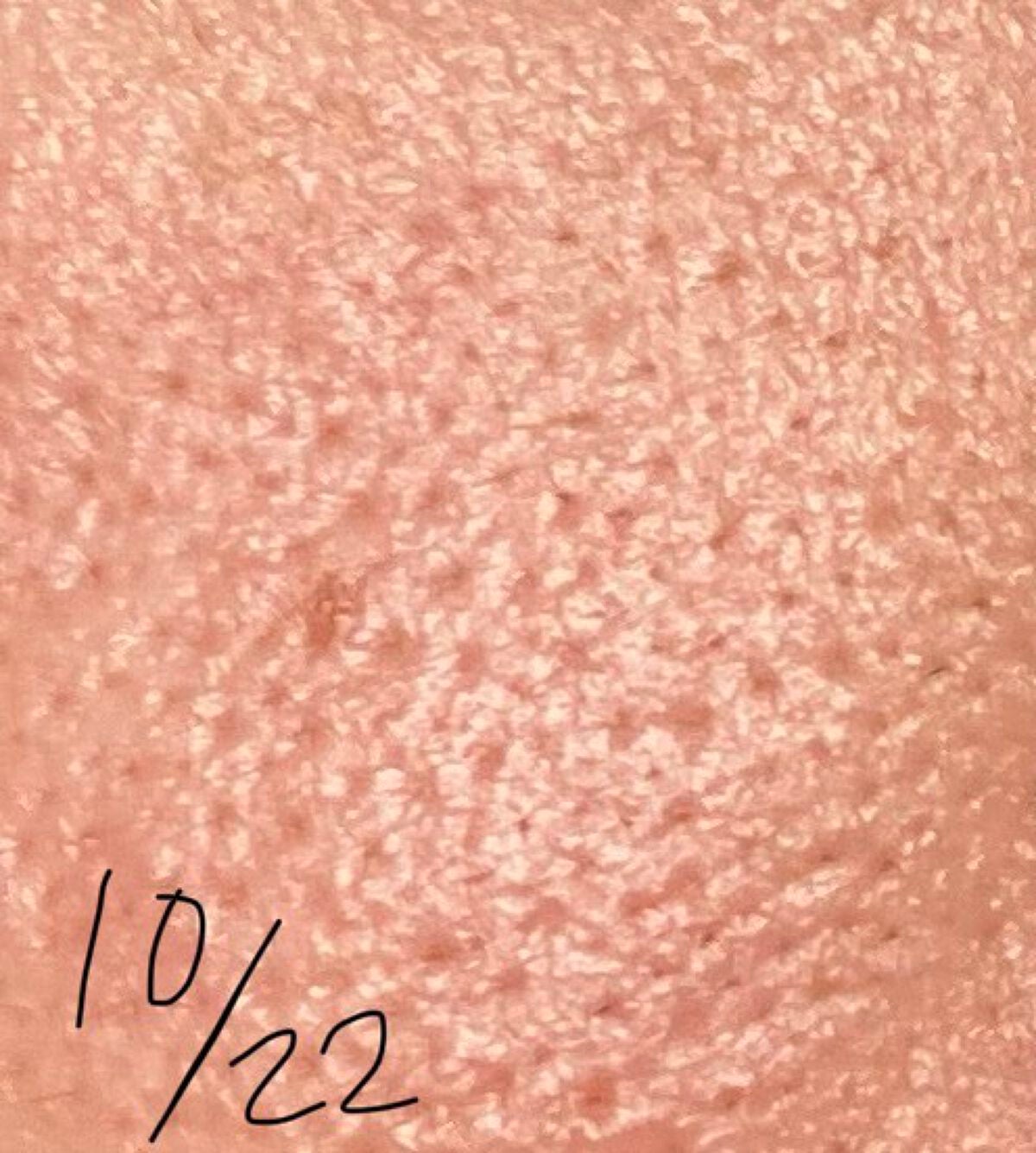 ガラクナイアシン2.0エッセンス/manyo/美容液を使ったクチコミ(4枚目)