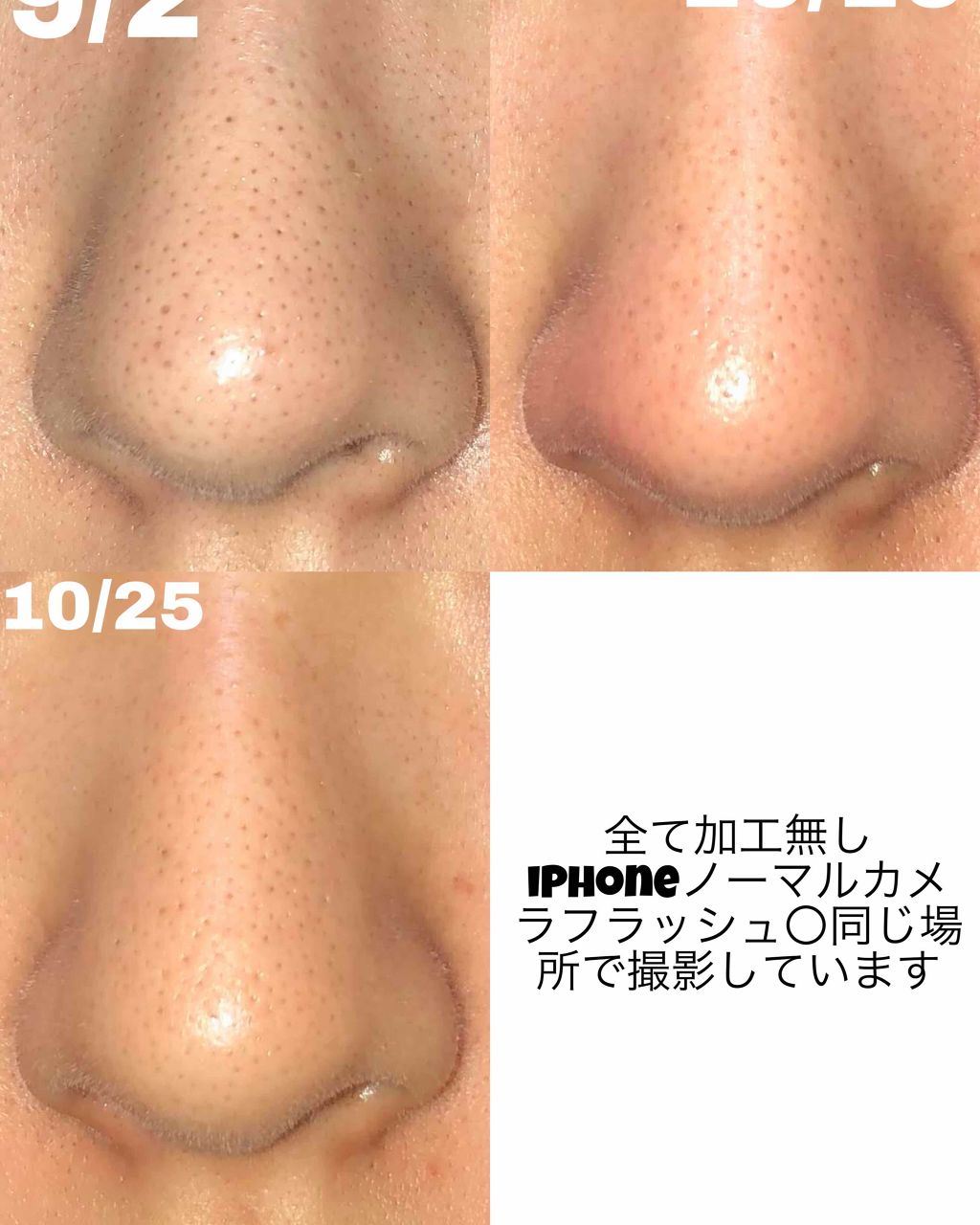 化粧水・敏感肌用・しっとりタイプ/無印良品/化粧水を使ったクチコミ(2枚目)