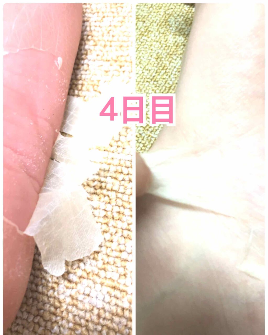 ひかピヨ (フォロバ100%) on LIPS 「削らず痛くない!!赤ちゃんのようなツルッツル✨ふわっふわ❤肌に..」(4枚目)