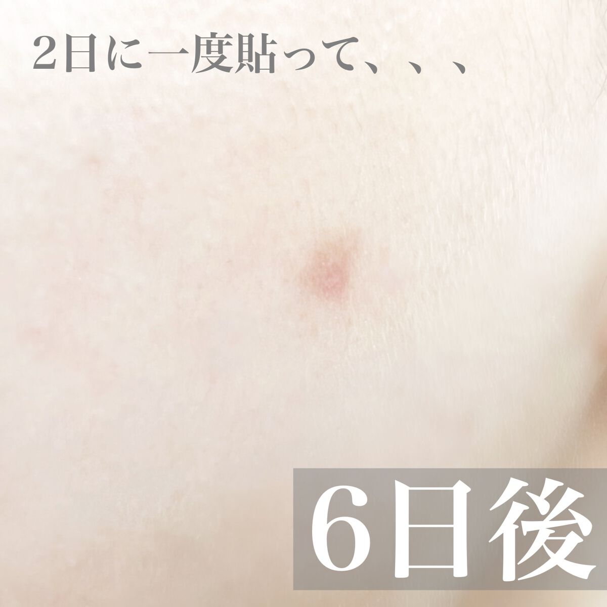 ディープビタCパッチ/MEDICUBE/その他スキンケアを使ったクチコミ(5枚目)