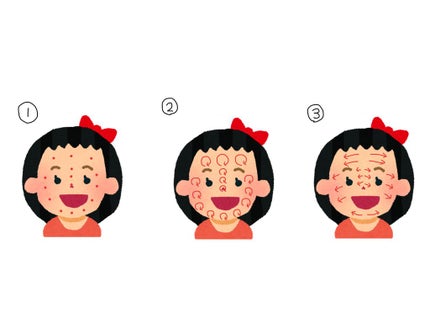 サンカットR ライトアップUV エッセンス/サンカット®/日焼け止めローションを使ったクチコミ(1枚目)