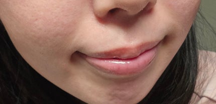 GLOWY TINT BALM/AOU/リップグロスを使ったクチコミ(3枚目)