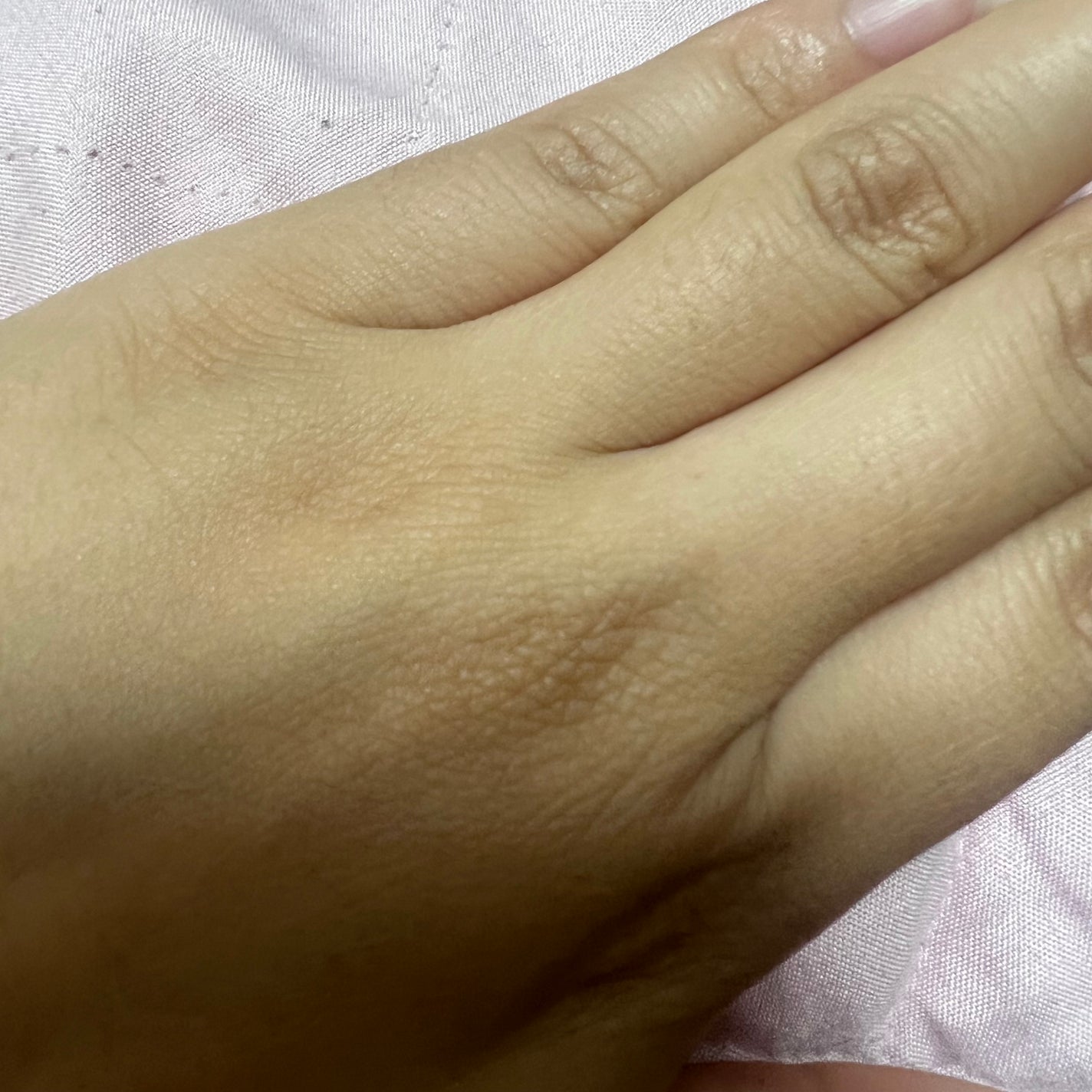 SIPL-1000C 家庭用光美容器/eosika/家庭用脱毛器を使ったクチコミ(3枚目)