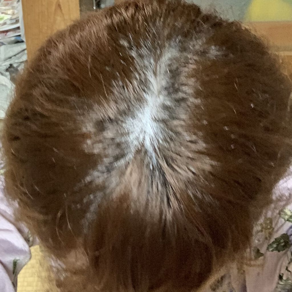 バニティカラー/ビューティラボ/ヘアカラーを使ったクチコミ（1枚目）