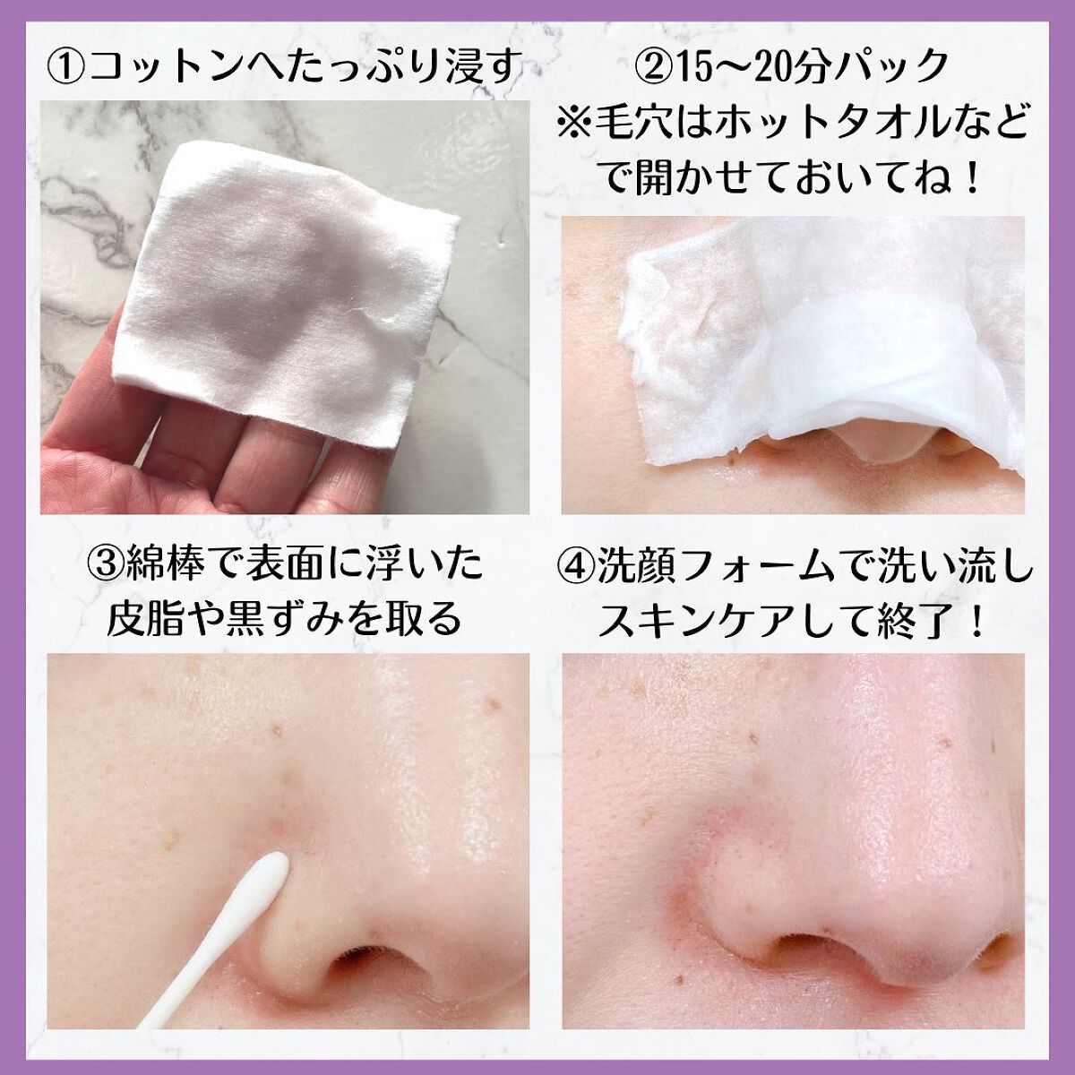 アクレオンセボエクストラクター/ANACIS/その他スキンケアを使ったクチコミ(2枚目)