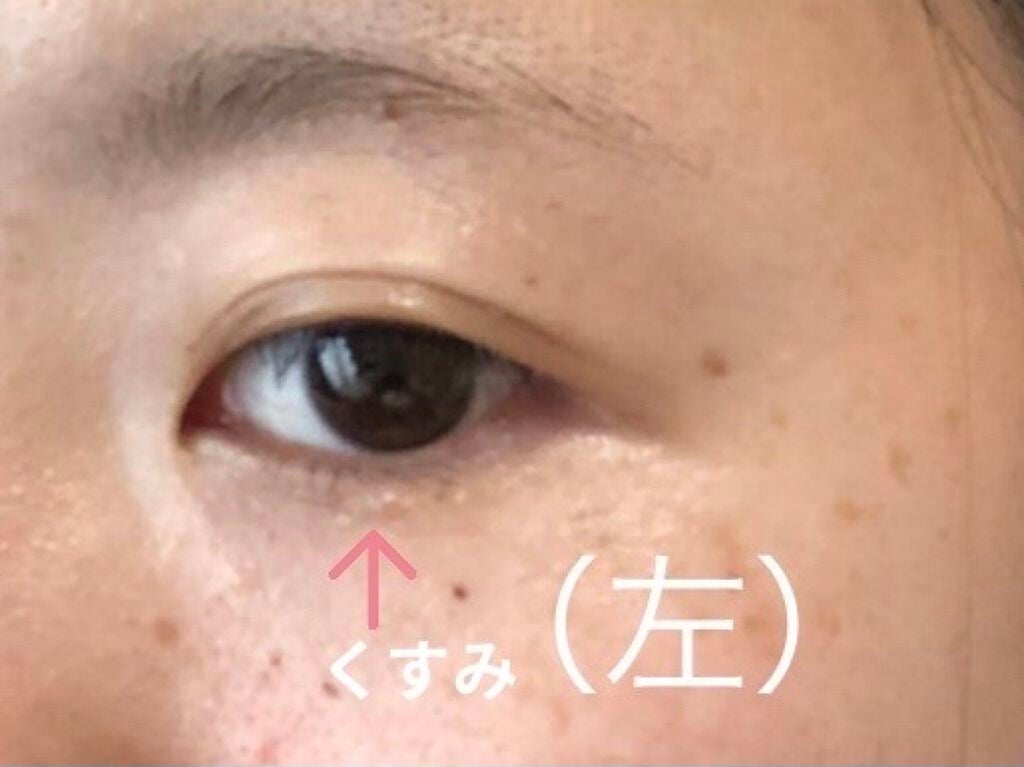 アイキララII/北の快適工房/アイケア・アイクリームを使ったクチコミ(2枚目)