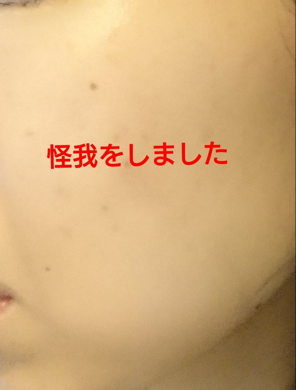 DHC ビタミンBミックス/DHC/美容サプリメントを使ったクチコミ(1枚目)