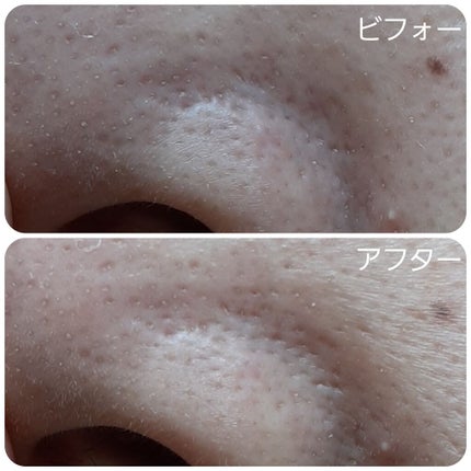 スーパーヴォルカニック ポア クレイマスク/innisfree/洗い流すパック・マスクを使ったクチコミ(2枚目)