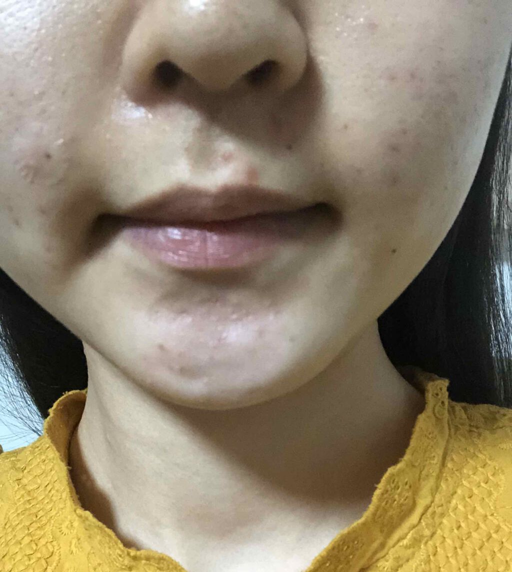 オリーブヤング ケアプラス/Olive Young/その他を使ったクチコミ（3枚目）