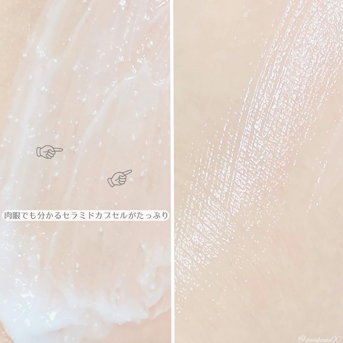 アトバリア365クリーム/AESTURA/フェイスクリームを使ったクチコミ(4枚目)