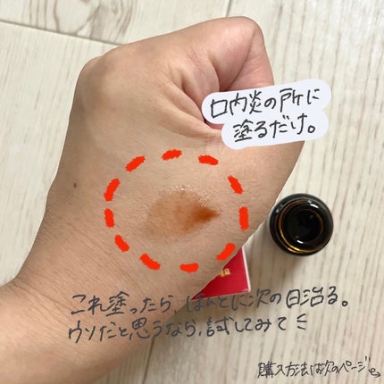 ðððð€ËË on LIPS ãå£å
ç飿°éå~ð«¶ïŒå£å
çã£ãŠãäžåºŠã§ãããšãªããªãæ²»ããèŸ..ãïŒ5æç®ïŒ