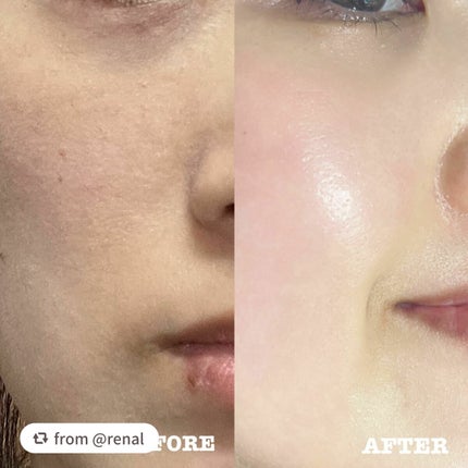 フェイシャルブースティングスパ/Makeon/美顔器・マッサージを使ったクチコミ(5枚目)