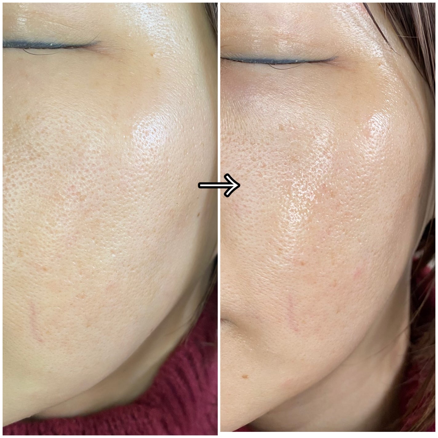 9番 NMNバイオリフトラッピングマスク/numbuzin/シートマスク・パックを使ったクチコミ(7枚目)