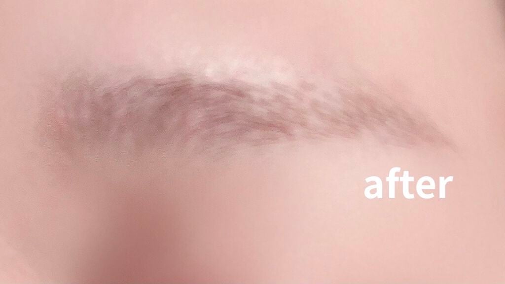 脱色クリーム スピーディー/エピラット/ムダ毛ケアを使ったクチコミ(1枚目)