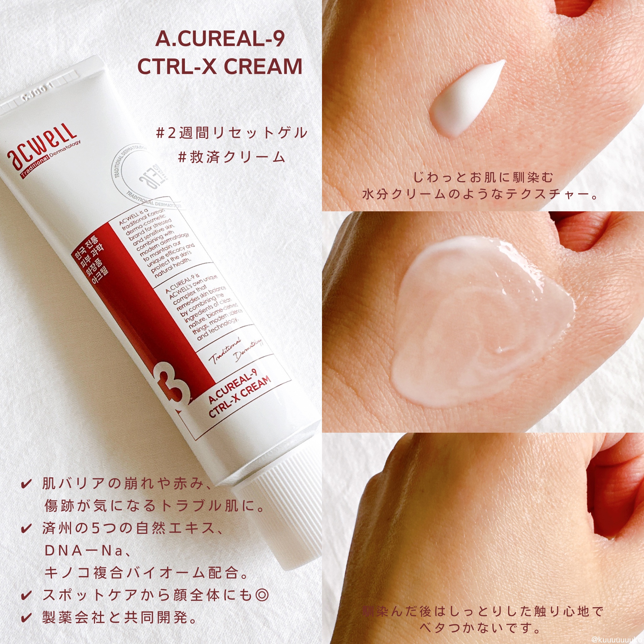 アキュリアルナインコントロールエックスクリーム/ACWELL/フェイスクリームを使ったクチコミ（2枚目）