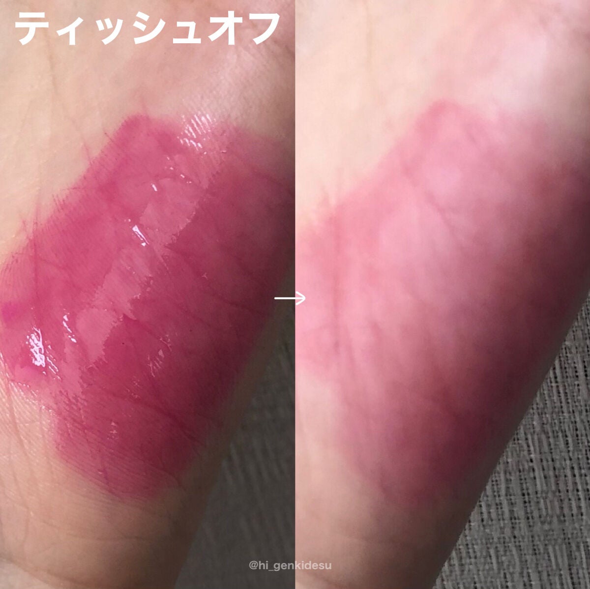 フルーティーグラムティント/Laka/リップティントを使ったクチコミ(5枚目)