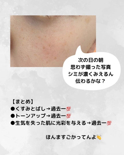 グルタチオンブアンプルマスク/Genabelle/シートマスク・パックを使ったクチコミ(6枚目)