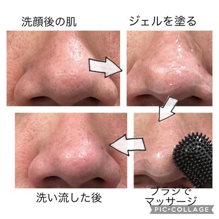 チョコブラ スペシャル毛穴ケアセット/Chocobra/スキンケアキットを使ったクチコミ(5枚目)