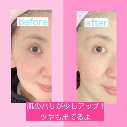 フレッシュ98ゲルマスク/ELEGADOLL/シートマスク・パックを使ったクチコミ(6枚目)